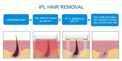 IPL OPT Laser Hair Removel Machine for Women 3 IN 1 ND YAG Q Switch Tattoo Removal Professional RF Face Lift Skin Tight Device
