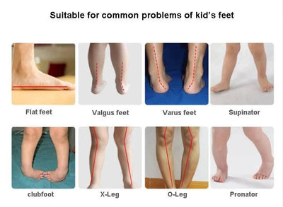 Children's Orthopaedic Footwear |  Flatfeet Sandals/ Shoes For Kids | Barefoot Princess Baby Toddler | Size20 21 22