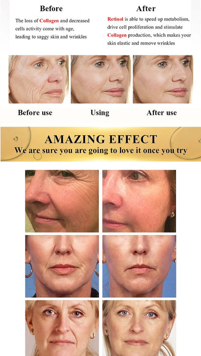 Retinol Facial Cream Firming, Lifting, Anti-aging Fine Lines, Whitening, Brightening, Moisturizing, Facial Skin Care 20g