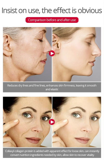 Retinol Facial Cream Firming, Lifting, Anti-aging Fine Lines, Whitening, Brightening, Moisturizing, Facial Skin Care 20g