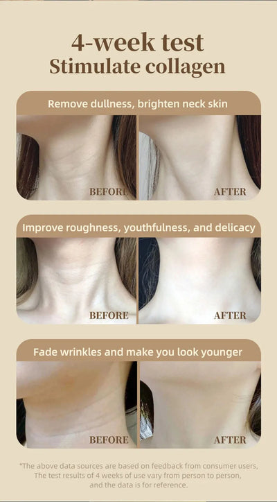 2025 Neck LED Lift Mask Photon Anti-Wrinkle Skin Tightening Neck Beauty Device Skin Brighten Rejuvenation Neck Wrinkle Remover