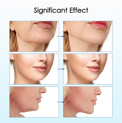 Face Lifting Device Red Light Skin Rejuvenation V Face Massager Double Chin Lift Up with Remote Control Facial Beauty Instrument