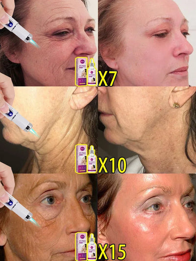 Electronic anti-wrinkle stretching whitening portable beauty care equipment for women and man