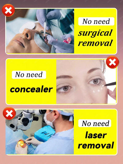 Vision Enhance Roller Promotes Clearer Eyesight Mild Relax Massage Reduces Discomfort Relieve Dry Eyes Fatigue Health Eye Care