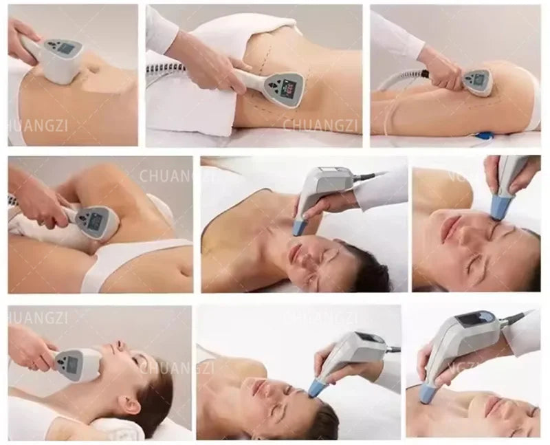 360 Fat Slimming Machine 2 in 1 Monopolar Radiofrequency Facial Rejuvenation and Firming Super Wrinkle Removal Face Lift