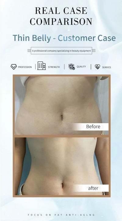 INDIBA Spain Technology Face Care Devices 448K Tecar Cavitation Body Care RET CET RF Slim Machine for Loss Health Beauty