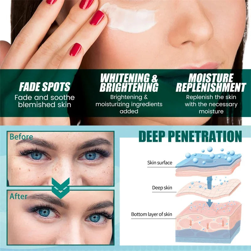 Dark Spot Corrector Skin Whitening Fade Cream Lighten Blemish Removal Serum Reduces Freckles Melasma Sun Spot Brighten Skin Care