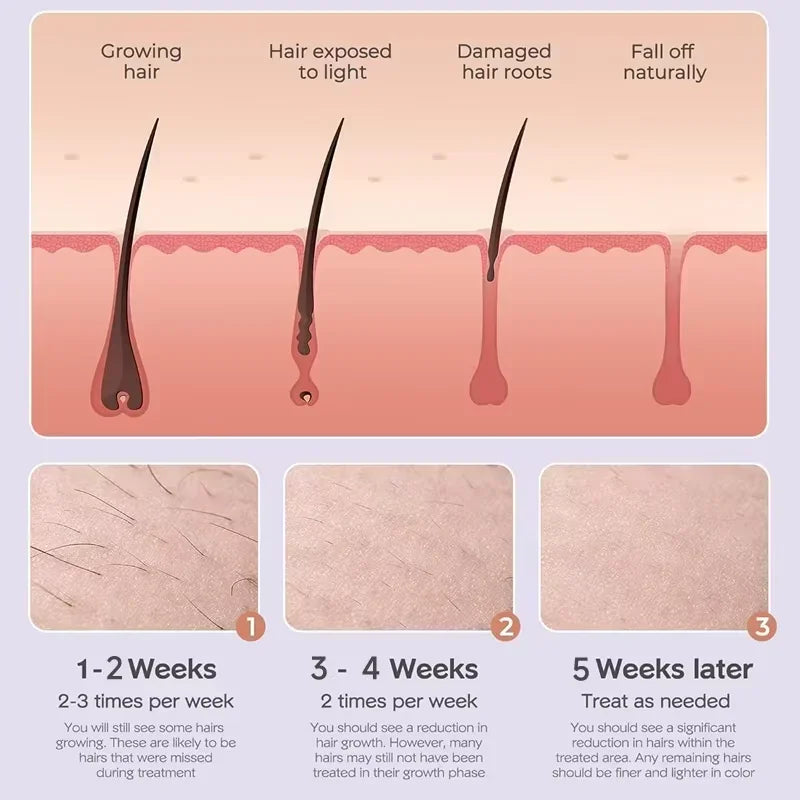 Professional Women Laser Hair Removal IPL Epilator Female Pulsed Light Electric Depilatory Device For Facial Body Bikini