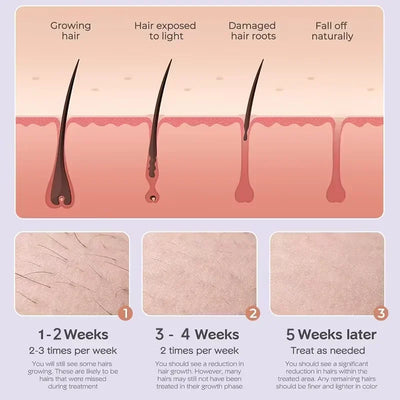 Professional Women Laser Hair Removal IPL Epilator Female Pulsed Light Electric Depilatory Device For Facial Body Bikini