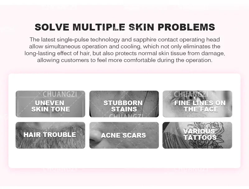 IPL OPT Laser Hair Removel Machine for Women 3 IN 1 ND YAG Q Switch Tattoo Removal Professional RF Face Lift Skin Tight Device