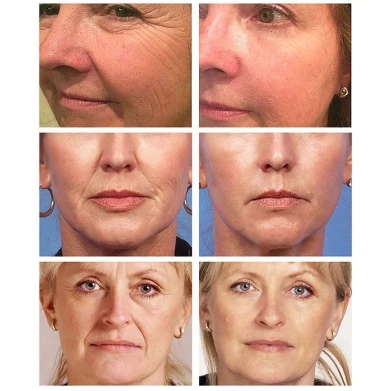 Retinol Facial Cream Firming, Lifting, Anti-aging Fine Lines, Whitening, Brightening, Moisturizing, Facial Skin Care 20g