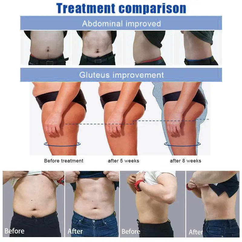 Portable Muscle Stimulation Body Sculpting Beauty Equipment Hot Sale RF HIEMT Machine Body Slimming Muscle Increase Device
