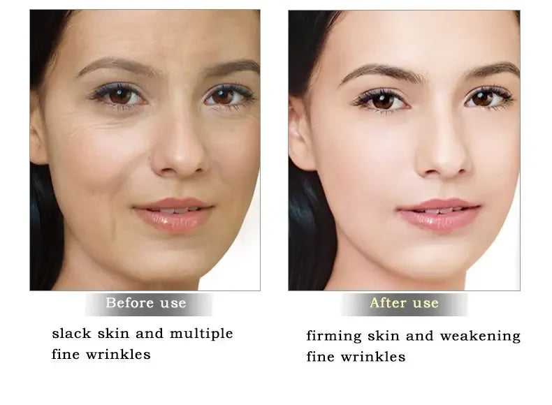 ARTISCARE Snail Face Cream + Peptide Eye Roller + Golden Eye Cream 3Pcs for Facial Moisturizing Serum Dark Circles Eye Care