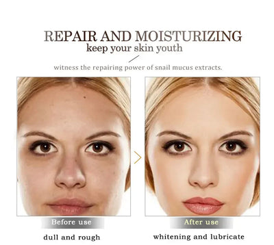 ARTISCARE Snail Face Cream + Peptide Eye Roller + Golden Eye Cream 3Pcs for Facial Moisturizing Serum Dark Circles Eye Care