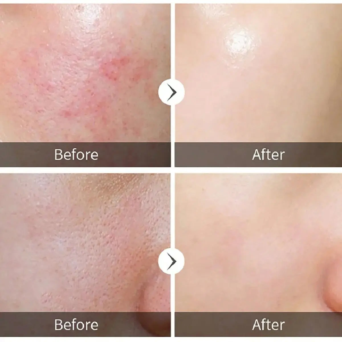 Facial Brightening Essence Essential Oil Is Suitable for Dry Skin to Maintain Skin Oil Balance and Moisturize