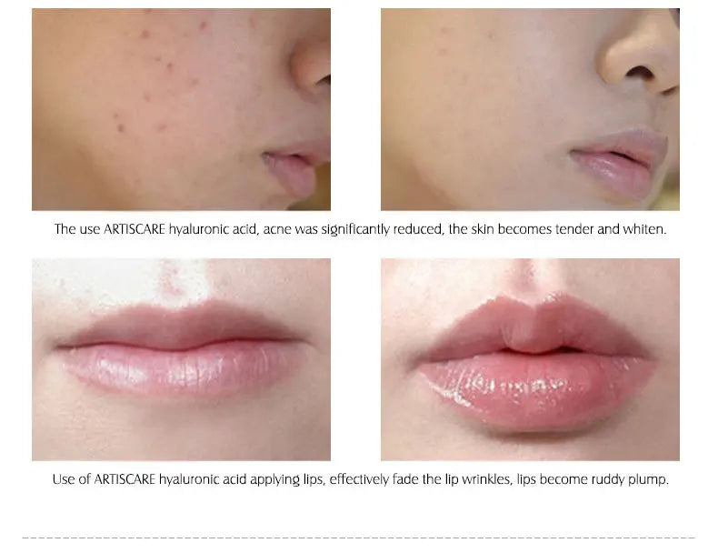 Hyaluronic Acid Solution Face Serum Moisturizing Nourishing Restore Elastic Skin Tightening and Lifting Facial Care Products