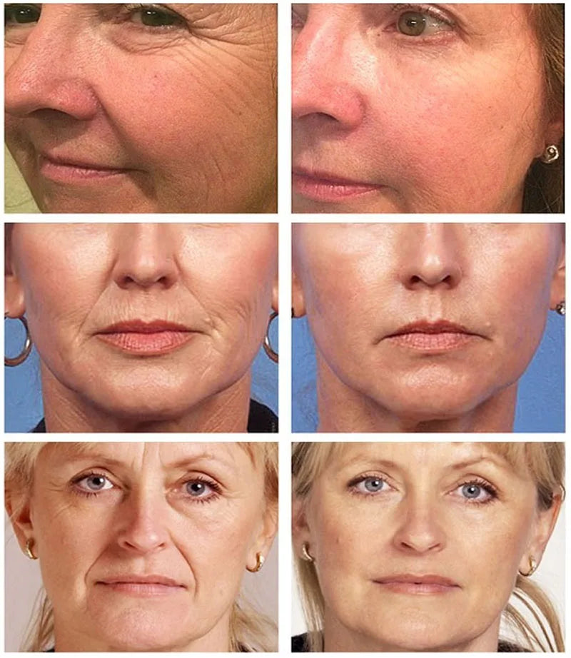 Magic Wrinkle Remover Face Cream Fade Fine Line Lifting Firming Moisturizing Skin Care All Purpose Cream All Natural Ingredients
