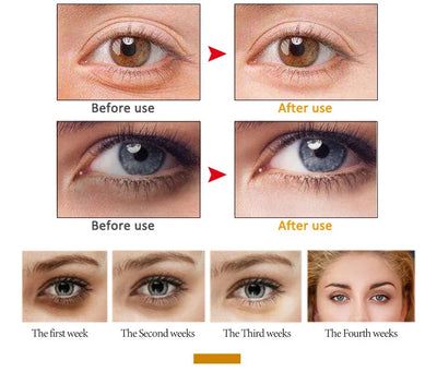 ARTISCARE Snail Face Cream + Peptide Eye Roller + Golden Eye Cream 3Pcs for Facial Moisturizing Serum Dark Circles Eye Care