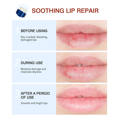 Lakerain Lip Repair Stick 2 Packs Quick Relief Of Dry Moisturizing And Smoothing lip Lines Lip Balm Soothes Chapping Lipstick
