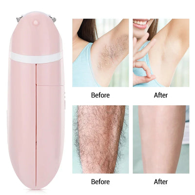 Electric Hair Removal Epilator For Women Hair Trimmer Shaver Bikini Underarms Arm Leg Face Private Parts Lady Razor Depilator