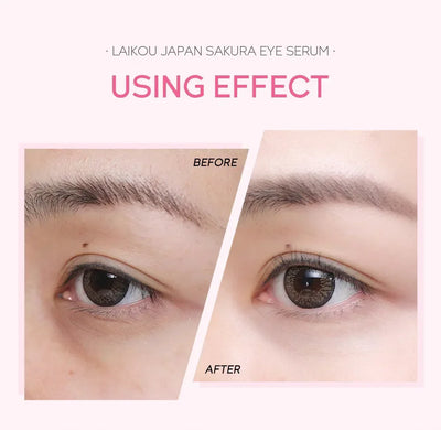 LAIKOU Sakura Eye Serum Eye Roller Massage Hyaluronic Acid Skin Care Eye Bags Cream Moisturizing Dark Circles 15ml