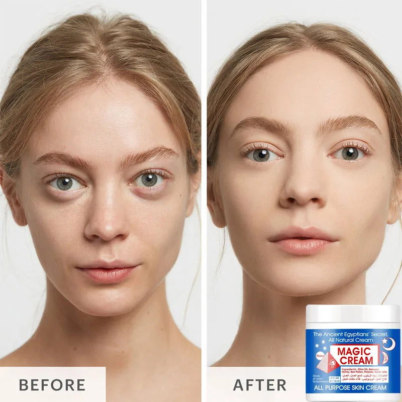 Magic Wrinkle Remover Face Cream Fade Fine Line Lifting Firming Moisturizing Skin Care All Purpose Cream All Natural Ingredients