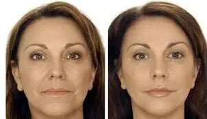 2pcs*118g Magic Facial Cream All Purpose Skin Face Cream Firms Tightens Moisturizing Nourishing brightened Skin Care