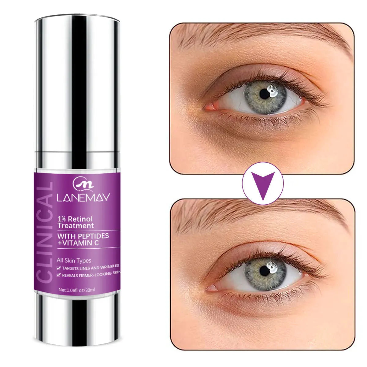 1% Retinol Eye Cream - Anti-Wrinkle, Firming  Hydrating with Peptides & Vitamin C Whitening Cream for Dark Skin Anti Aging Cream