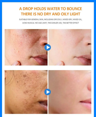 15ml Hyaluronic Acid for Face Serum Moisturizing Whitening Facial Essence Face Cream Repair Anti Aging Lifting Firming Skin Care