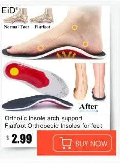 Kids Children 3D Orthopedic Insoles Arch Support insole for OX-Legs Flat Foot insoles Orthotic Pads Correction Health shoes pad