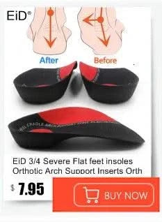 Kids Children 3D Orthopedic Insoles Arch Support insole for OX-Legs Flat Foot insoles Orthotic Pads Correction Health shoes pad