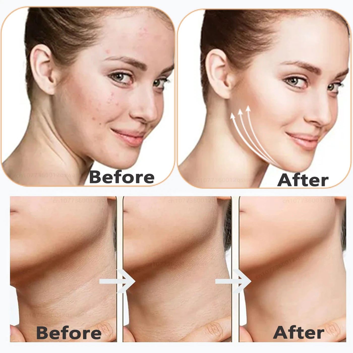 Neck Face Device Vibration Massage for Face and Neck Face Lifting Machine Microcurrents Red Light Therapy Anti Wrinkle