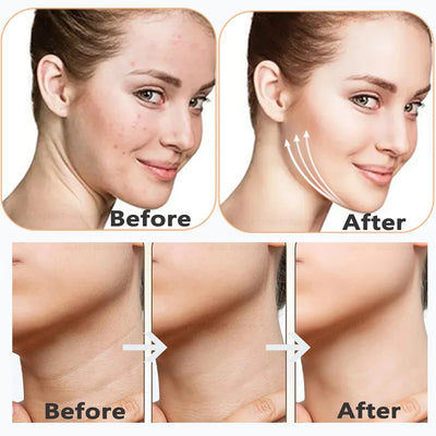 Neck Face Device Vibration Massage for Face and Neck Face Lifting Machine Microcurrents Red Light Therapy Anti Wrinkle