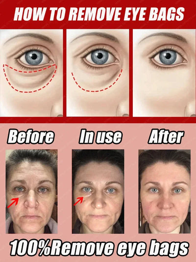 Vision Enhance Roller Promotes Clearer Eyesight Mild Relax Massage Reduces Discomfort Relieve Dry Eyes Fatigue Health Eye Care