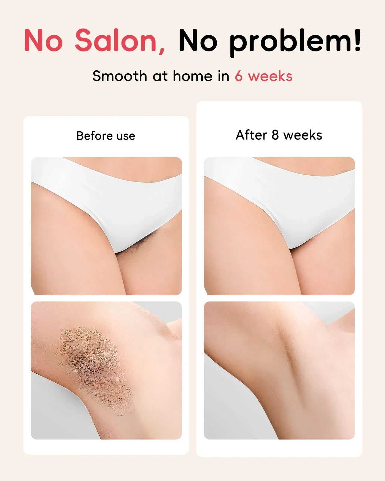 Laser Hair Removal 5.2 cm² Contact 22J IPL Unlimted Ultra-fast Light Emission Painless Long-Lasting Hair Remover for men women