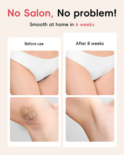 Laser Hair Removal 5.2 cm² Contact 22J IPL Unlimted Ultra-fast Light Emission Painless Long-Lasting Hair Remover for men women