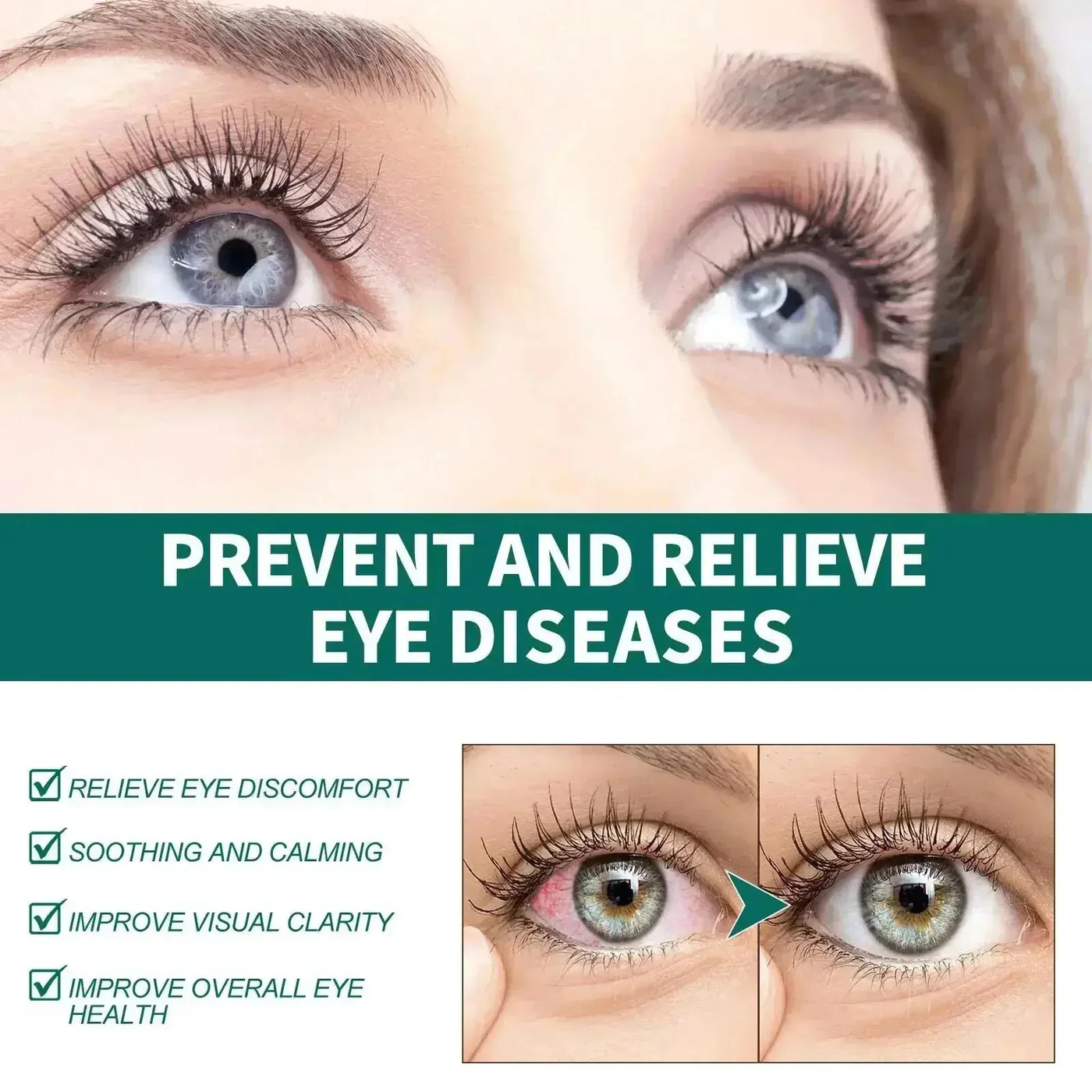 Vision Enhance Roller Promotes Clearer Eyesight Mild Relax Massage Reduce Discomfort Relieve Dryness Eye Fatigue Health Eye Care