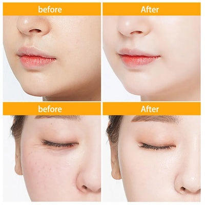 30Pcs Hyaluronic Acid Capsules Serum Hydrating Repair Moisturizing Essence Liquid Facial Deeply Nourishes Firming Skin Care
