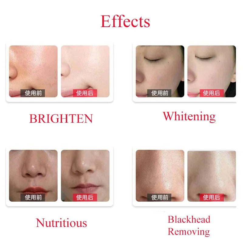 Facial Serum Clean Solution 50ml 3 Bottle/Set Solution For  Dermabrasion Skin Care Machine Care Salon Moisture Cleaner Machine