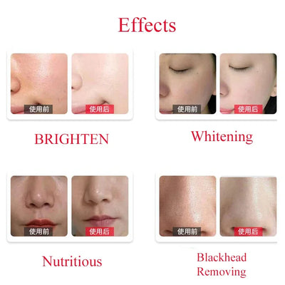 Facial Serum Clean Solution 50ml 3 Bottle/Set Solution For  Dermabrasion Skin Care Machine Care Salon Moisture Cleaner Machine