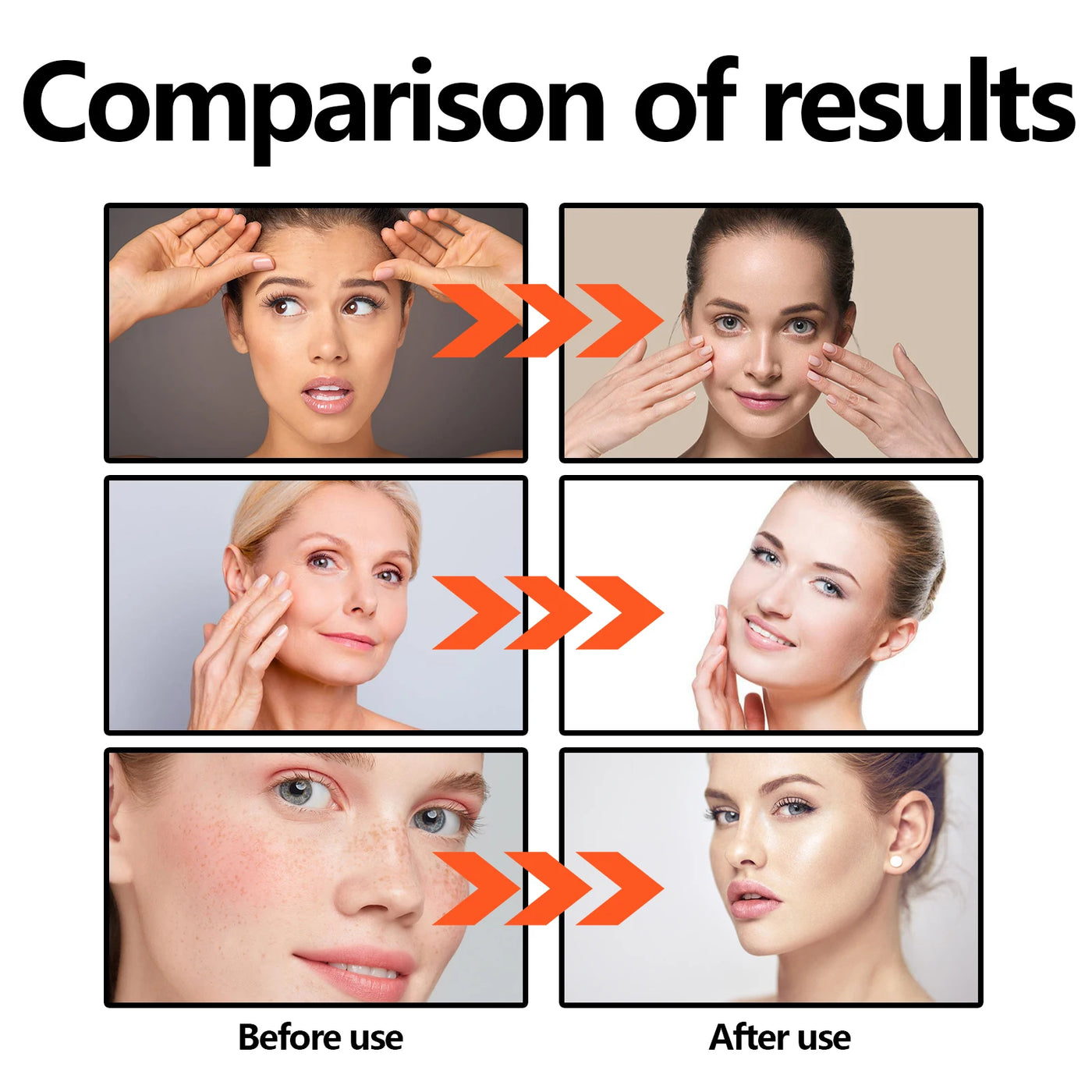 Vitamin C Face Serum 30ml Brightening, Anti Aging Tightens Minimizes Pores Hydrating Firming Essence for Fine Lines Dull Skin