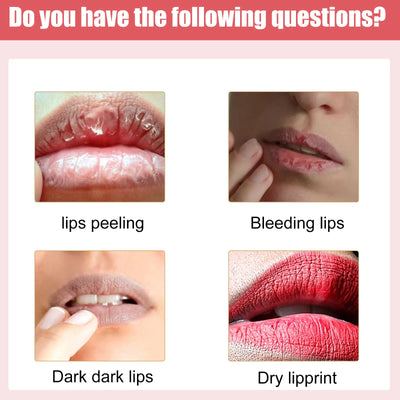 EELHOE Lip Lightening Cream Moisturizing Balm Whitening Brightening Nourishing Lipstick Remove Dark Lip Care Bleaching Cream 30g