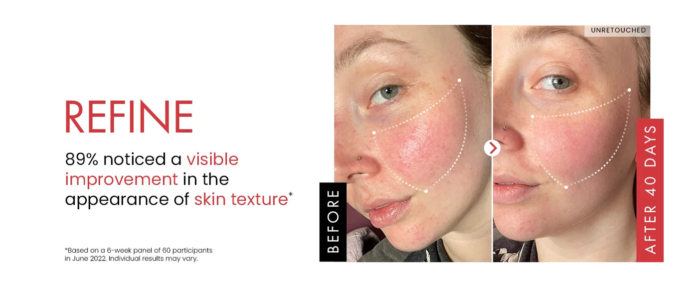 Remove Wrinkle Cream Retinol Face Anti-Aging Firming Lifting Fade Fine Lines Improve Skin Dryness Moisturiz Brighten Skin Care
