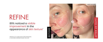 Remove Wrinkle Cream Retinol Face Anti-Aging Firming Lifting Fade Fine Lines Improve Skin Dryness Moisturiz Brighten Skin Care