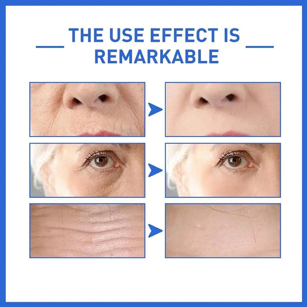 Anti Aging Serum Whitening Firming Fade Fine Lines Hydrating Facial Serum Reduces Wrinkles Skin Repair Nourishing For Skin Care