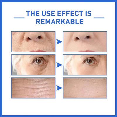 Anti Aging Serum Whitening Firming Fade Fine Lines Hydrating Facial Serum Reduces Wrinkles Skin Repair Nourishing For Skin Care