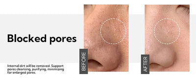 Pore Refining Serum Facial Essence Shrink Pores Moisturizing Anti-aging Oil Control Brighten Skin Tone Tighten Essence Skin Care