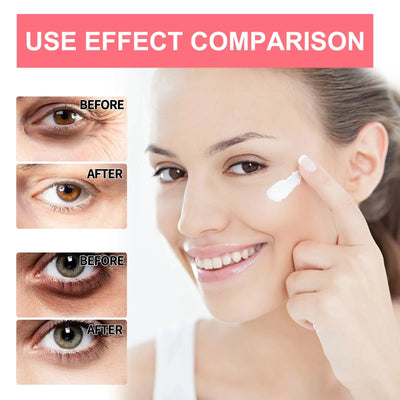 Retinol Eye Cream Lifting Firming Anti-Wrinkle Remove Eye Bags Dark Circles Anti Aging Whitening Moisturizing Brighten Skin Care