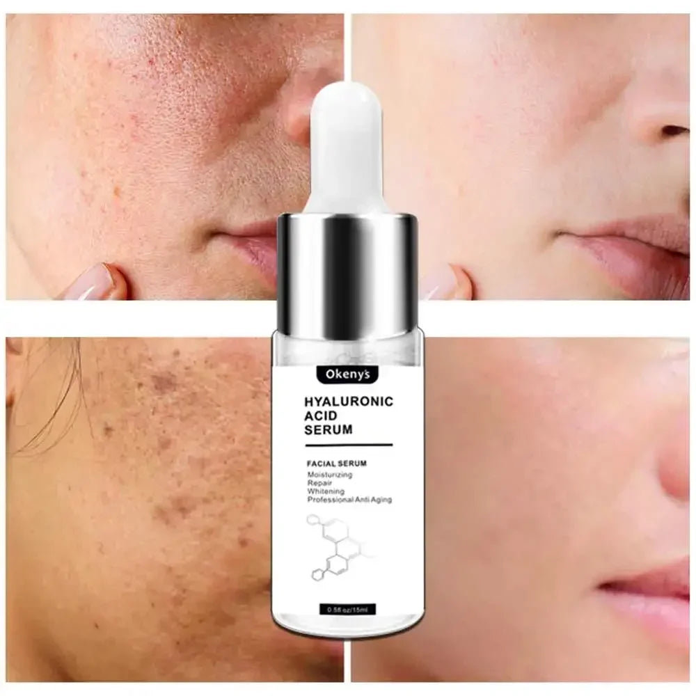 15ml Hyaluronic Acid for Face Serum Moisturizing Whitening Facial Essence Face Cream Repair Anti Aging Lifting Firming Skin Care