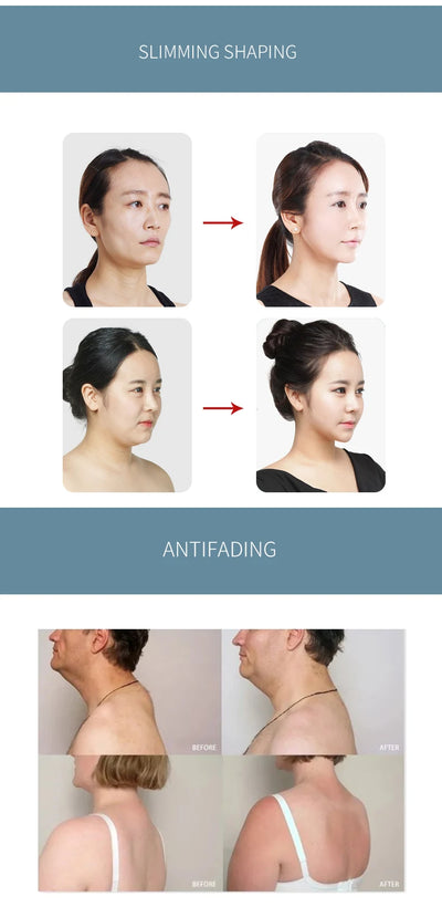 INDIBA Spain Technology Face Care Devices 448K Tecar Cavitation Body Care RET CET RF Slim Machine for Loss Health Beauty